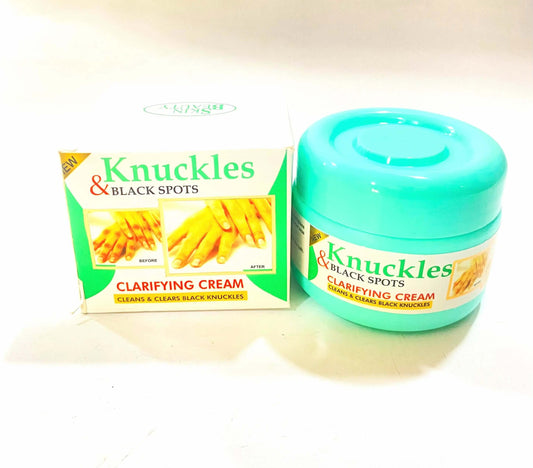 Knuckles and Black Spots Cream La Mimz Beauty & Fashion Store